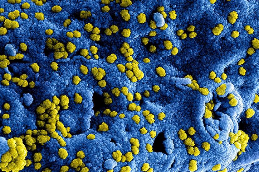 Coronavirus vastgesteld bij inwoner uit Boekel