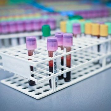 Prikpost Bernhoven gaat verhuizen